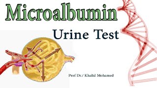 Microalbumin MA Urine Albumin Albumin to Creatinine Ratio [upl. by Tiemroth]