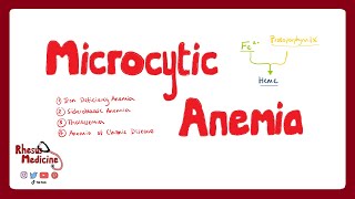 MICROCYTIC ANEMIA Iron Deficiency Anemia Anemia of Chronic Disease Sideroblastic Anemia  Rhesus [upl. by Oesile967]