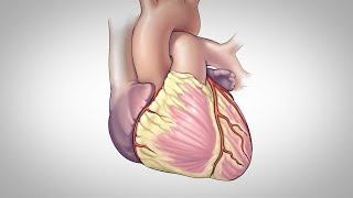 Coronary Angiography Albert Raizner MD [upl. by Disharoon]