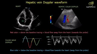 Understanding hepatic vein Doppler waveform  slideshow I POCUS I Dr Koratala [upl. by Orlando628]