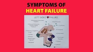 Symptoms of Heart Failure [upl. by Kcirrej]