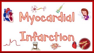 Myocardial InfarctionHeart Attack Causes Pathogenesis Signs amp Symptoms Diagnosis amp Treatment [upl. by Lisabeth]