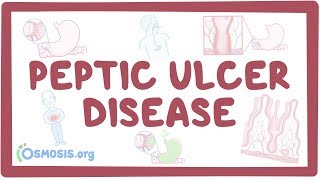 Peptic ulcer disease  causes symptoms diagnosis treatment pathology [upl. by Chesna866]