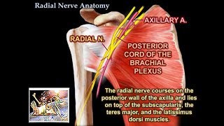 Radial tear posterior hornroot junction [upl. by Ahsaekal]