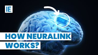 Elon Musk’s Neuralink gets FDA Approval See How It Works [upl. by Tiphanie]