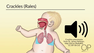 Respiratory Assessment by B Leary L DelSignore  OPENPediatrics [upl. by Khalsa]