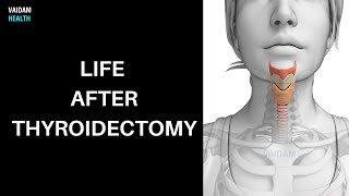 Life after Thyroidectomy [upl. by Ellenij504]