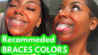 Choose THESE COLORS on your next braces appointment [upl. by Idel196]