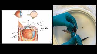 Eye Dissection Instructions [upl. by Odranreb]