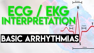 Basic Arrhythmias  Sinus Brady Tachy Premature Beats  ECG EKG Interpretation Part 3 [upl. by Najed]