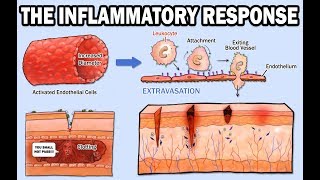 THE INFLAMMATORY RESPONSE [upl. by Takeo]