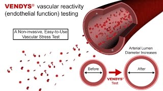 VENDYS  Endothelial Function Measurement Explained [upl. by Dolli]