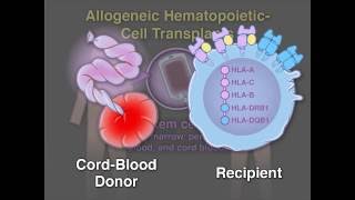 Diagnosis of Myelodysplastic Syndromes MDS [upl. by Tadashi]