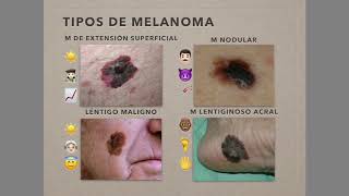 Melanoma [upl. by Anitan]