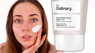 The Best Inexpensive Moisturizer  The Ordinary Natural Moisturizing Factors  HA Review [upl. by Bashemath]