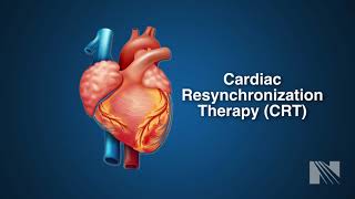 Ventricular Fibrillation Treatment Cardiac Resyncrhoniation Therapy CRT [upl. by Cinda]