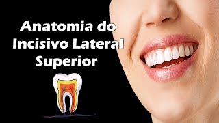 Aula de Anatomia Dental  Anatomia do Incisivo Lateral Superior  Dente 12 e 22 [upl. by Wenz]