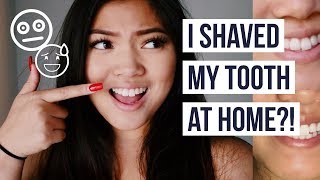 I SHAVED MY TOOTH WITH A NAIL FILER  Straightened My Teeth at Home [upl. by Yrovi992]