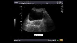 Ultrasounds during pregnancy [upl. by Elocal]