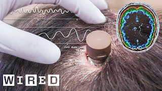 The Science Behind Elon Musk’s Neuralink Brain Chip  WIRED [upl. by Arezzini810]