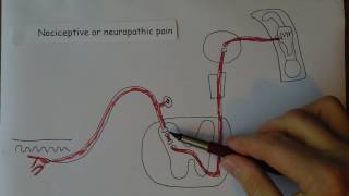 Neuropathic pain [upl. by Onid646]