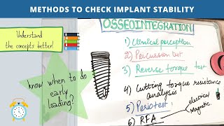 osseointegration of dental implants  final part [upl. by Nicolette]