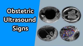 Obstetric Ultrasound Signs [upl. by Ferri37]