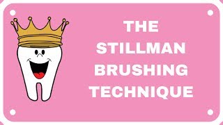 Stillman Brushing Technique [upl. by Eseerehs]