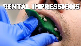 Dental Impressions amp Pouring Teeth Models [upl. by Dredi]