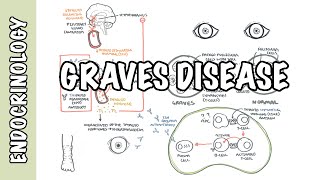 Neurology  Topic 20  Myasthenia gravis and Ptosis [upl. by Dopp]