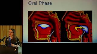 The ABCs of videofluoroscopy of swallowing [upl. by Hplar]