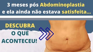 Resultados de Abdominoplastia como melhorar o seu abdome [upl. by Quint644]