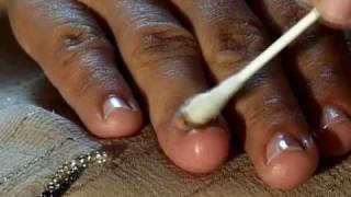 How to Cure Nail Fungus [upl. by Carlee]