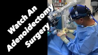 The Doctors  Pediatric Adenoidectomy [upl. by Aneetsirk150]