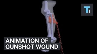 Animation of gunshot wound [upl. by Alain]