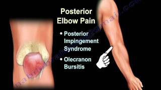 ELBOW PAIN  COMMON CAUSES  Everything You Need To Know  Dr Nabil Ebraheim [upl. by Haonam]