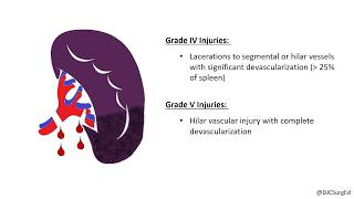 Splenic Injury [upl. by Arakihc]