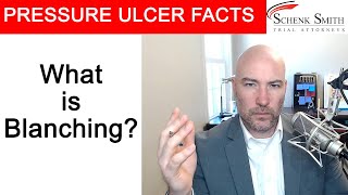 Pressure Ulcer Fact 31 Understand blanching [upl. by Ymmat]