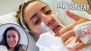 MY JAW SURGERY EXPERIENCE  Before and After [upl. by Misak]