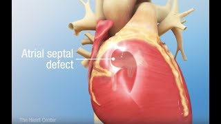 interatrial Septum development [upl. by Yila]