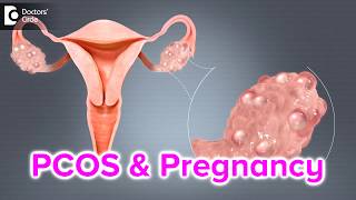 Polycystic Ovarian Syndrome PCOS Nutrition and Diet Guide [upl. by Marillin]