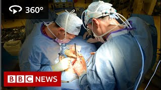 In 360 Oesophageal cancer operation filmed  BBC News [upl. by Nylyahs865]