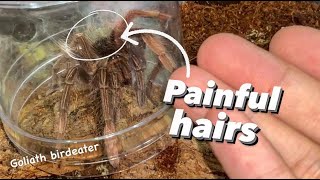 These TARANTULA HAIRS aren’t even itchy  THEY’RE PAINFUL [upl. by Il]