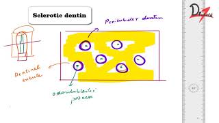 What is Sclerotic dentin [upl. by Hayidah]