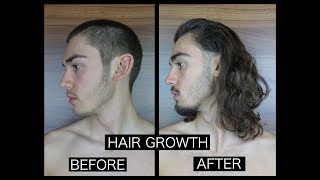 HAIR GROWTH TIME LAPSE  SIDE [upl. by Llabmik262]