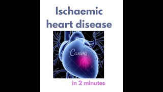 Ischemic Heart Disease in under 2 mins [upl. by Schuman]