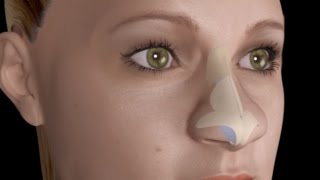 Unblock Nose in Five Minutes  Buteyko Breathing Method [upl. by Hyacinth]