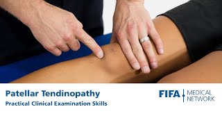 Best SelfTreatment for Chondromalacia Patellofemoral Pain [upl. by Ryter18]