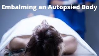 Embalming an autopsied body [upl. by Wolff]