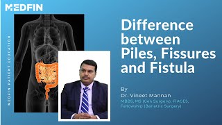 What is the difference between Piles Fissures and Fistula [upl. by Aldus648]